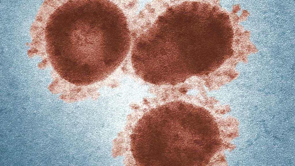 Strep A infection The Ivy Medical Group