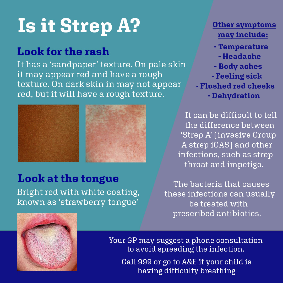 Group A streptococcal infections can cause strep throat, scarlet fever